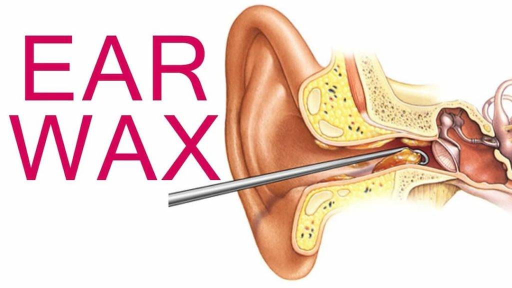 Infographic About Ear Wax (1)